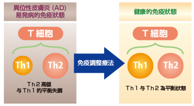 免疫調整療法