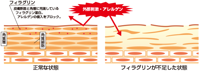 フィラグリンとは